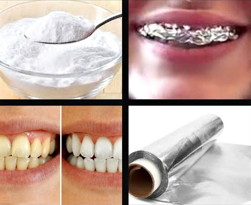خلطات طبيعية منزلية لتبييض الاسنان